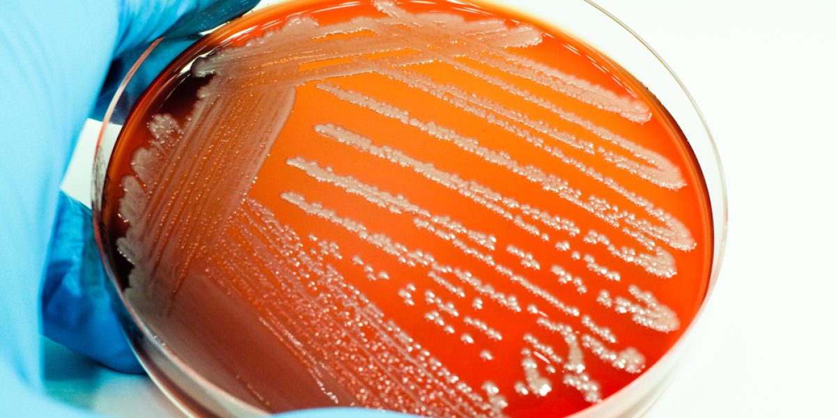 Colonies,Of,White,Bacteria,Culture,On,Media,Blood,Agar,Experiment